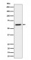 Anti-IKZF3 Rabbit Monoclonal Antibody
